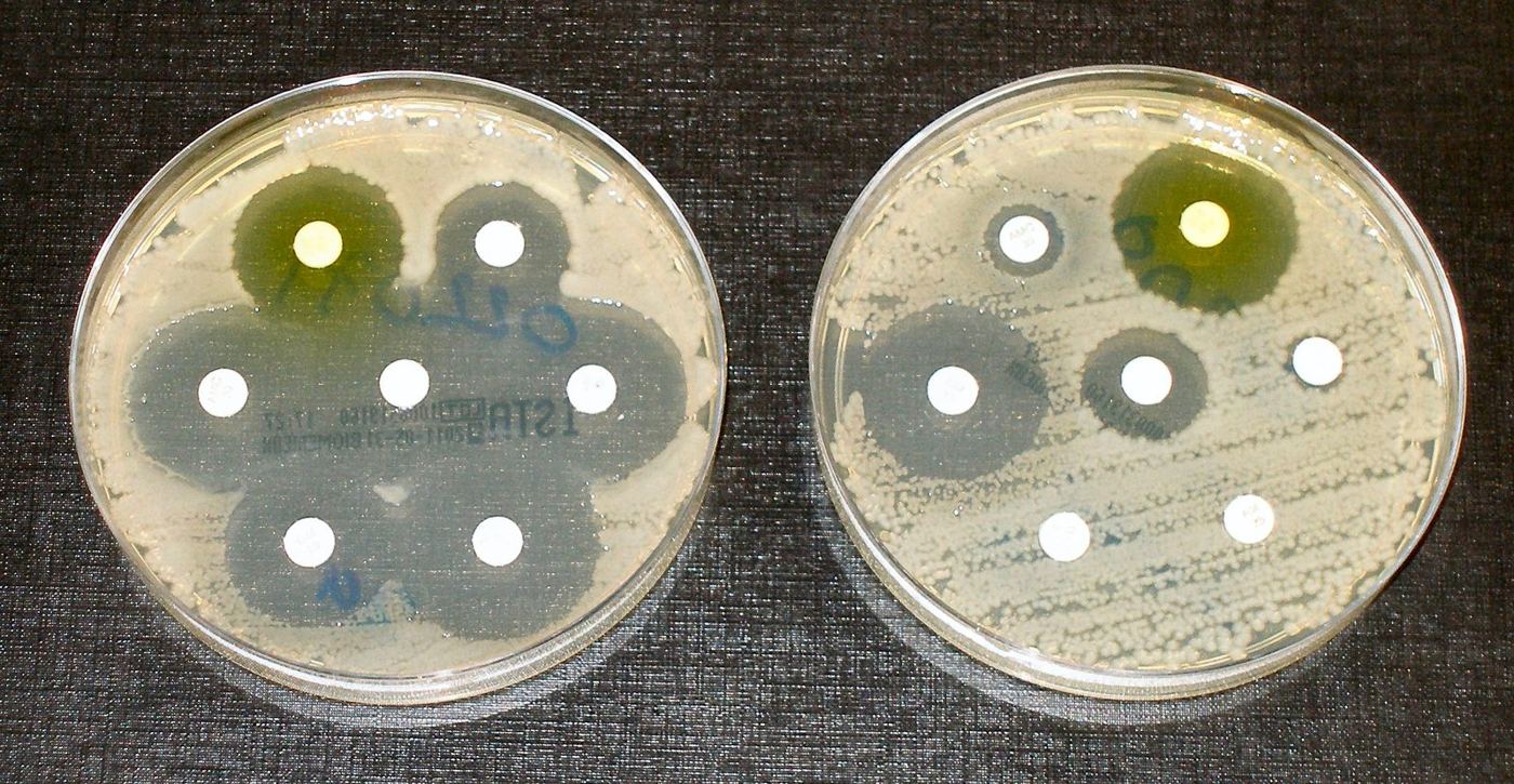 Two lab dishes of bacteria with white antibiotic discs: clear rings around every disc on the left, few or none on the right